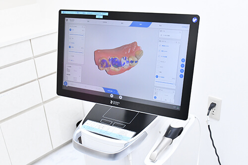 セレック、口腔内スキャナー
