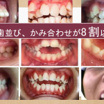 最近の子供達の口腔の発育について